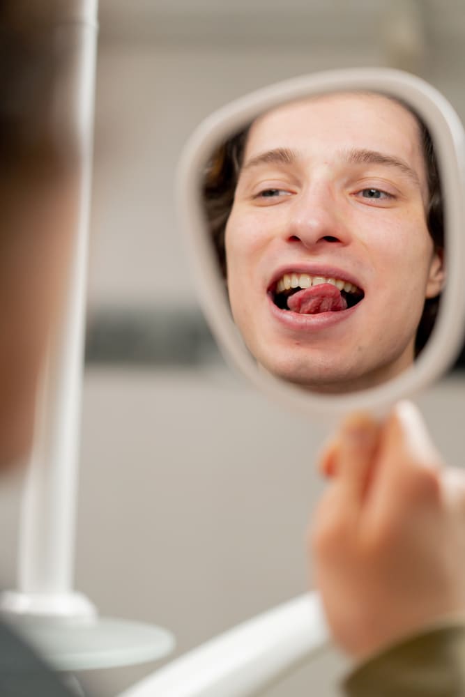 Gengive che sanguinano - Uomo che controlla le gengive | Dentista Treviso