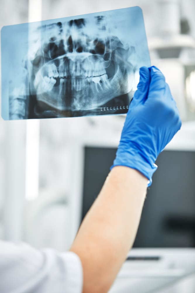 Prima di estrarre un dente, guardiamo a fondo con tutti gli strumenti più avanzati che la tecnologia di mette a disposizione.